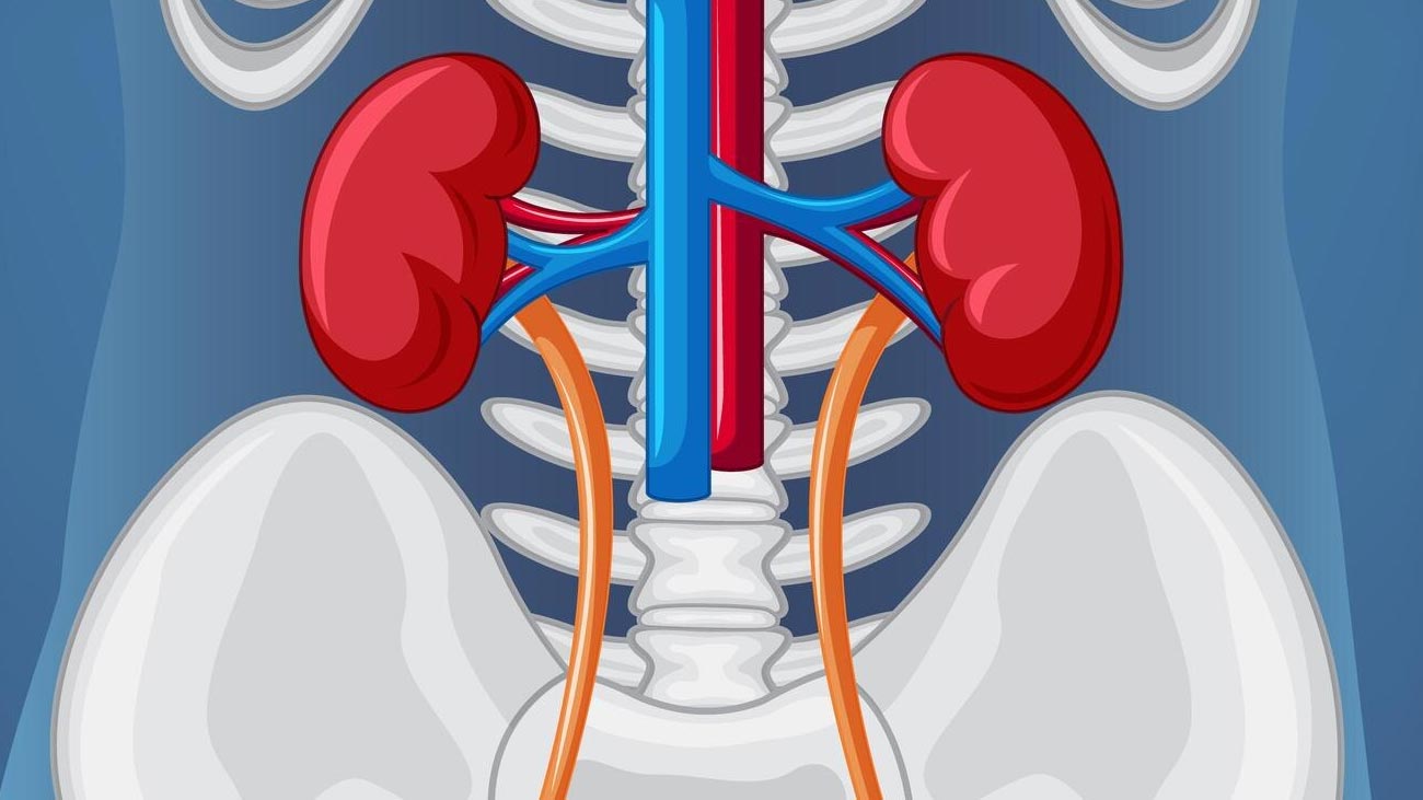 28 Most Common Kidney Stone Myths