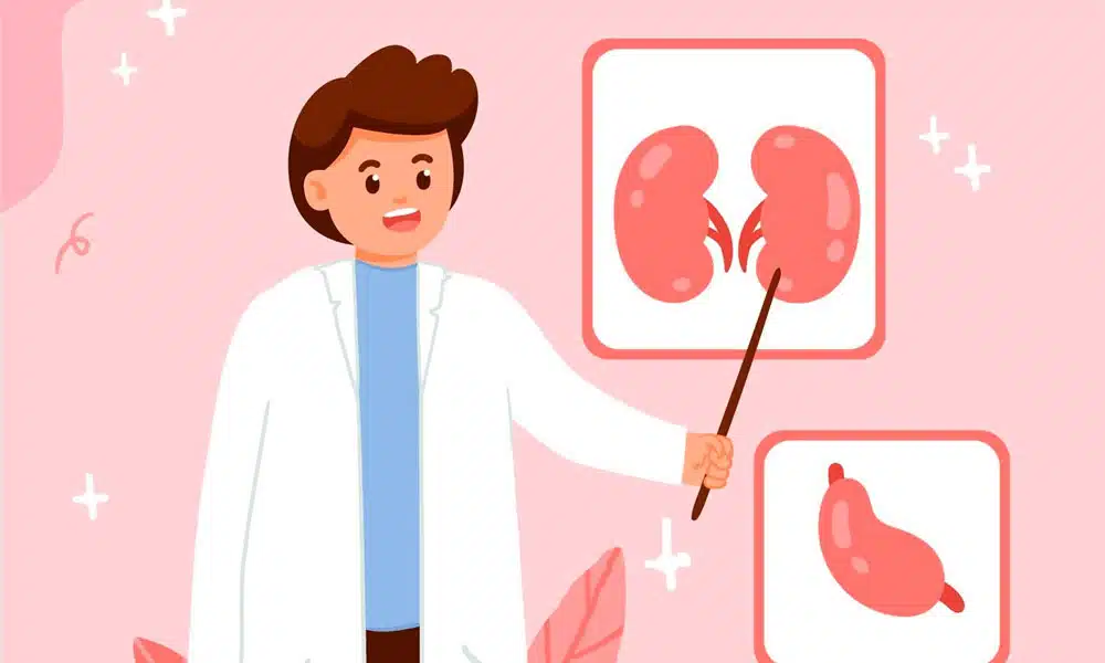 How to Manage Calcium Phosphate Stones