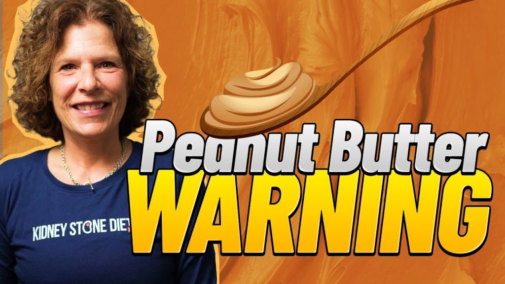 Will peanut butter give me kidney stones?