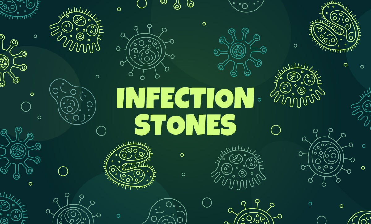 Infection Stones (aka Struvite): What Kidney Stone Patients Need to Understand