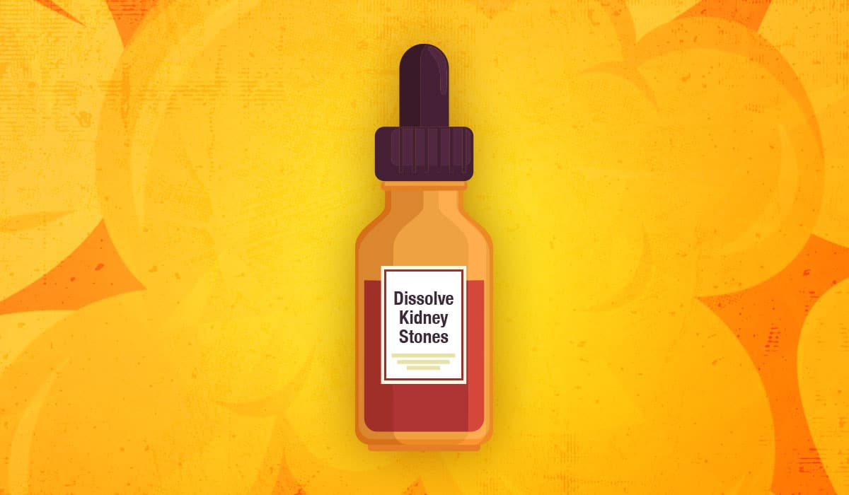 Can You Dissolve a Kidney Stone?