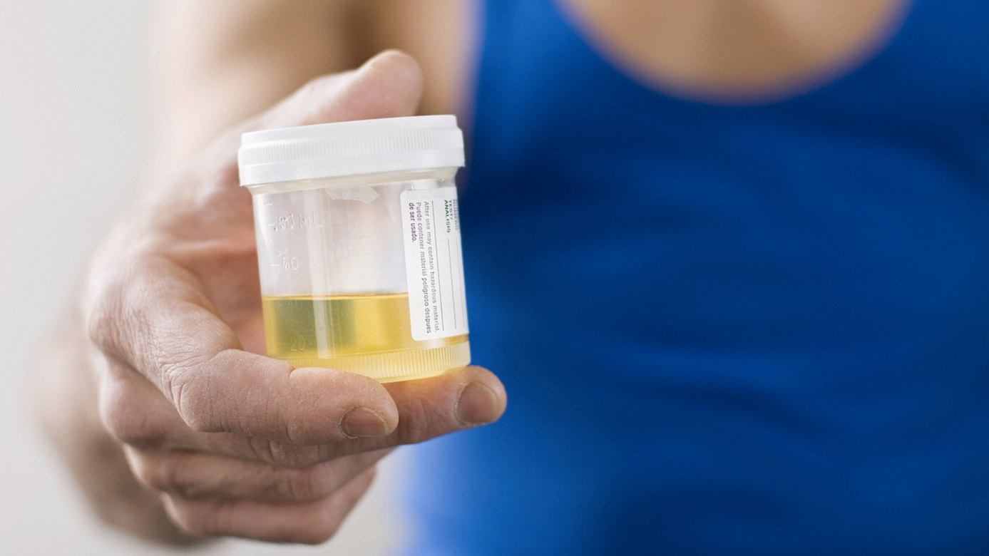 24-Hour Urine Collections: Why They Matter and How to Approach Them