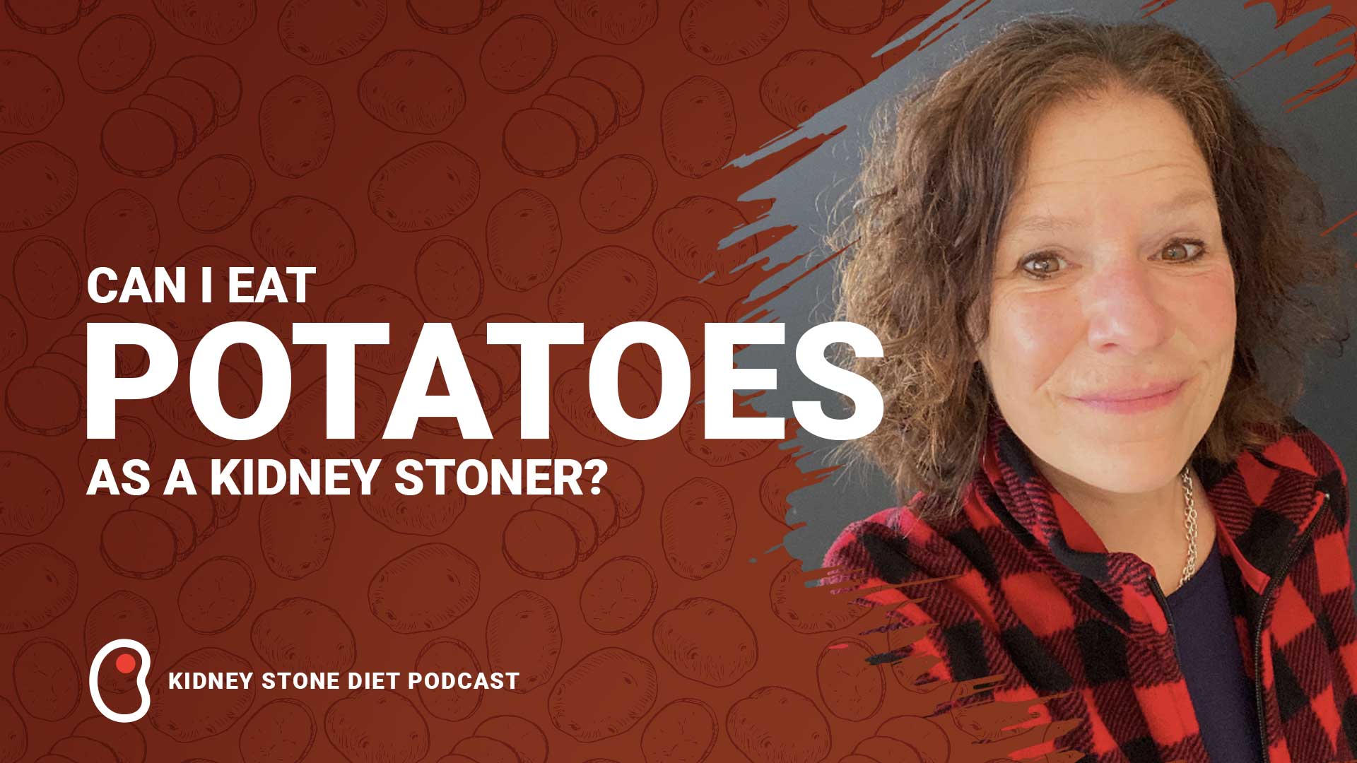 Can I Eat Potatoes as a Kidney Stoner?