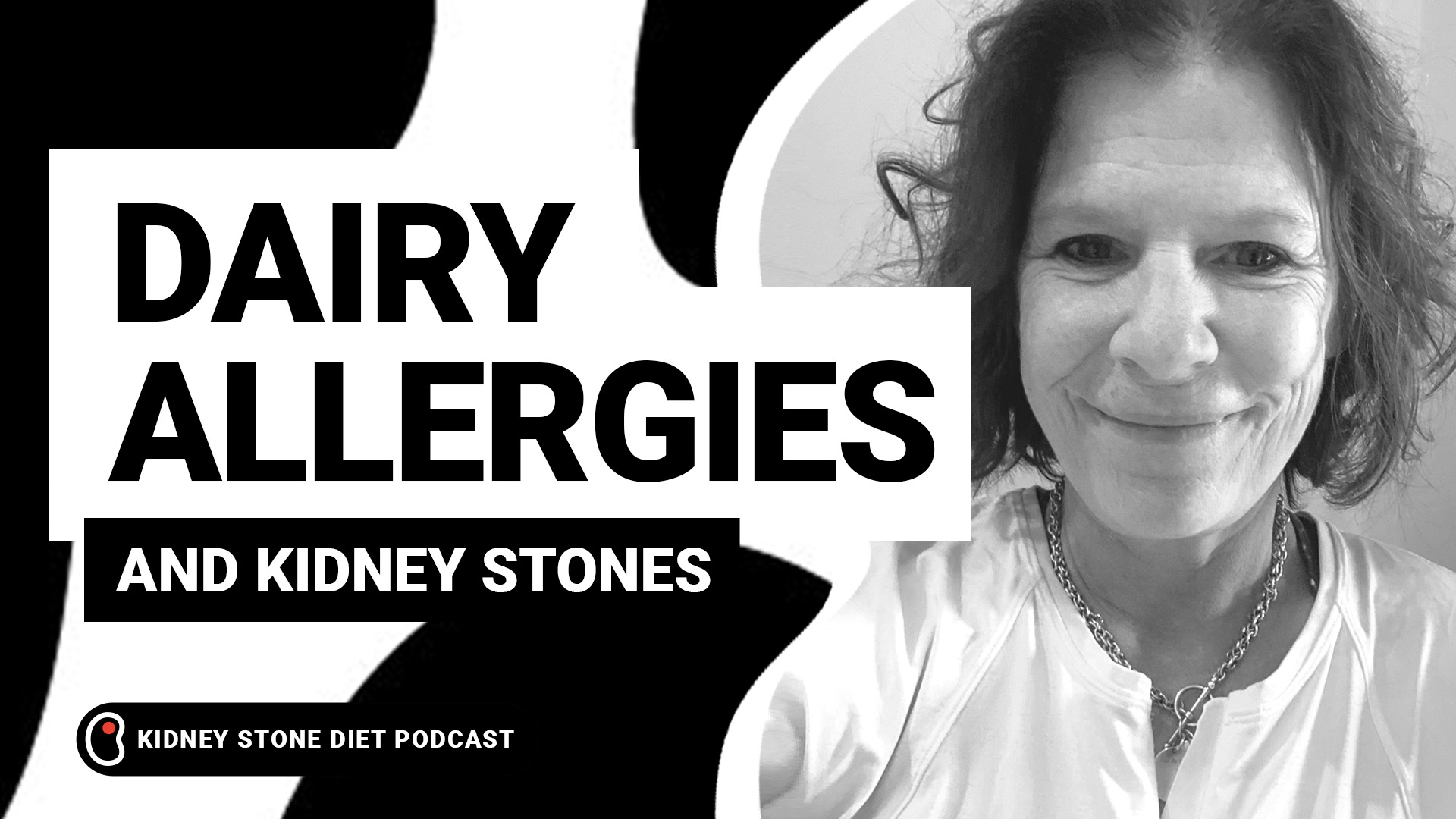Dairy allergies and kidney stones