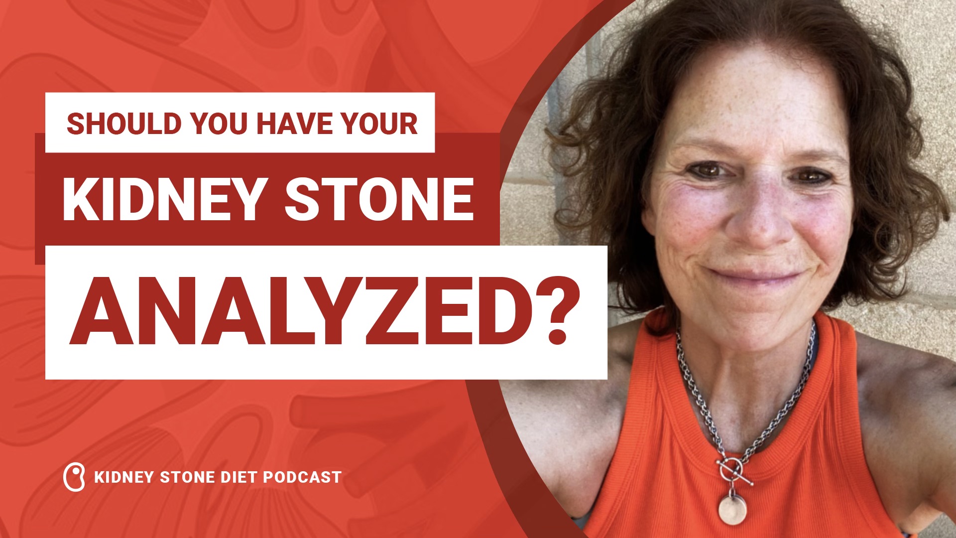 Should you have your kidney stone analyzed?