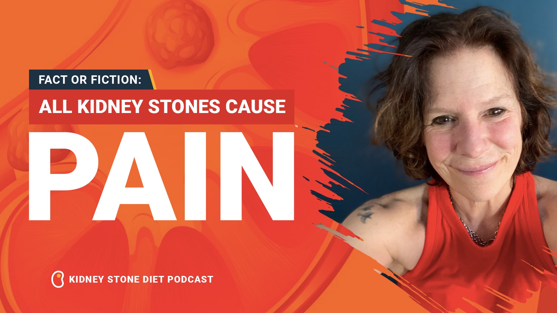 Fact or Fiction: All kidney stones cause pain