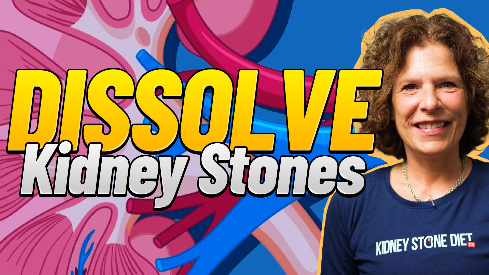 Can apple cider vinegar (ACV) treat kidney stones?
